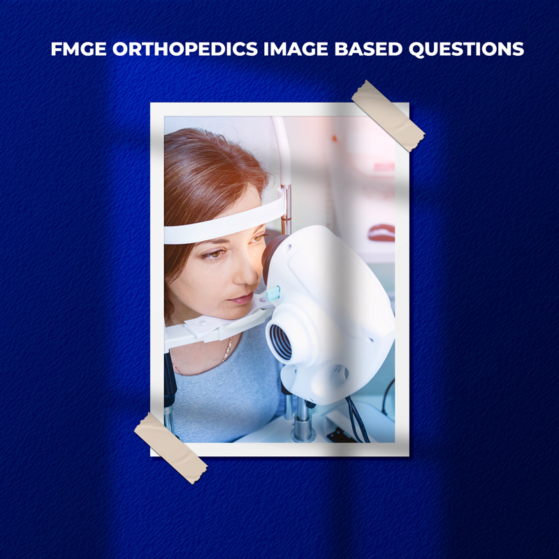 FMGE Ophthalmology Image Based Questions