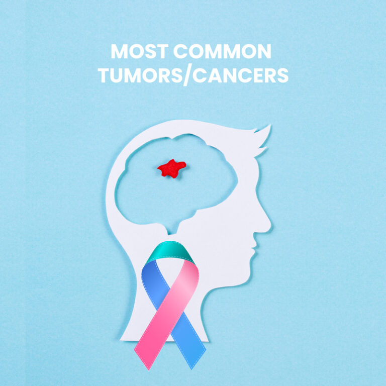 MOST COMMON TUMORS/CANCERS