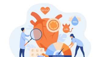 Cardiovascular System – Arrhythmias – Atrial Fibrillation